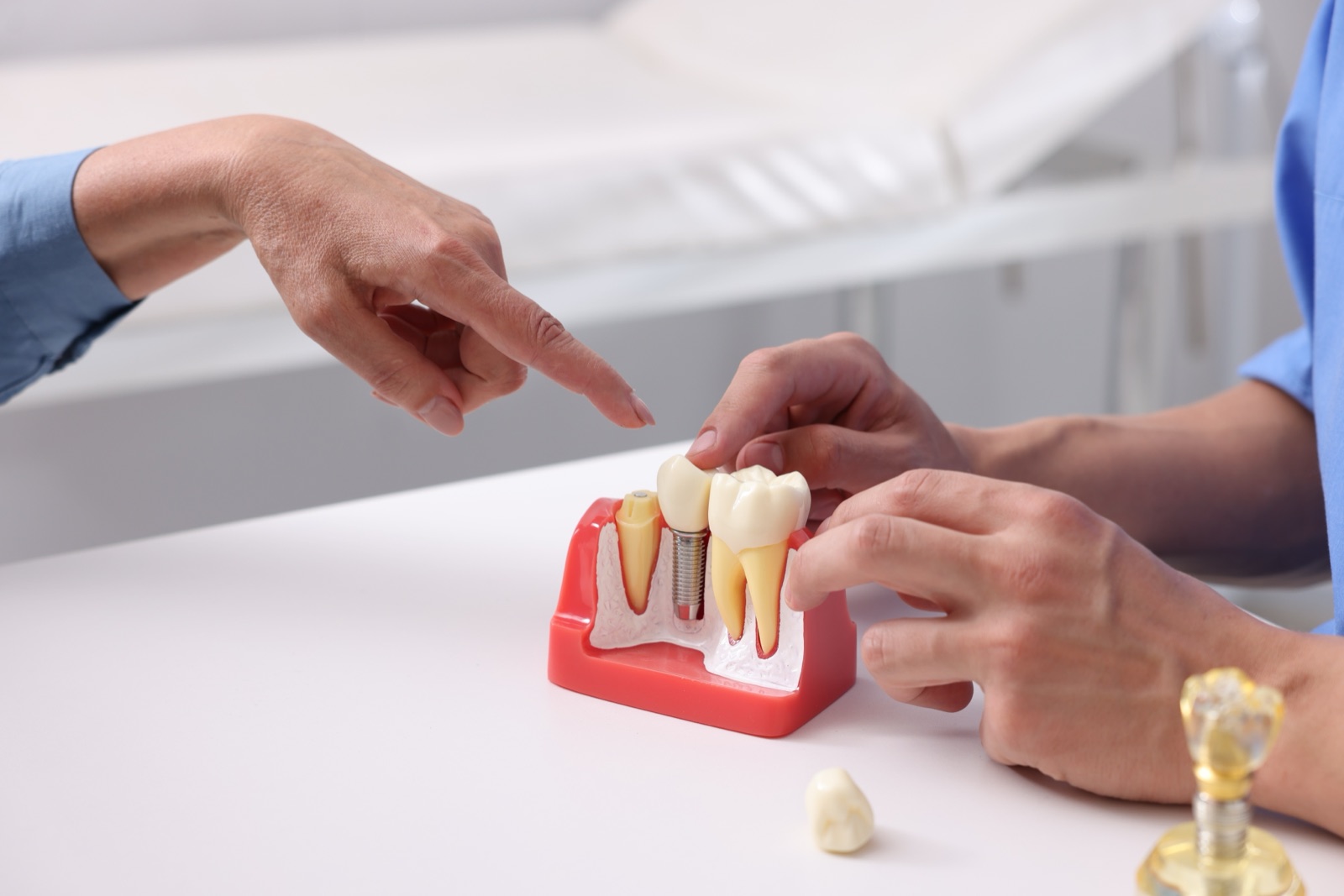 Dental Implants